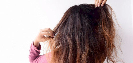 أكلات تمنع تساقط الشعر: أفضل الأطعمة لصحة شعرك