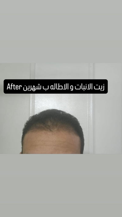 بعد — يوم ٦٠