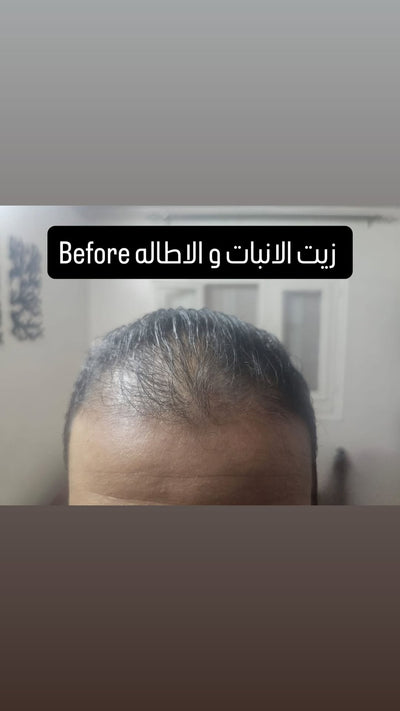 قبل